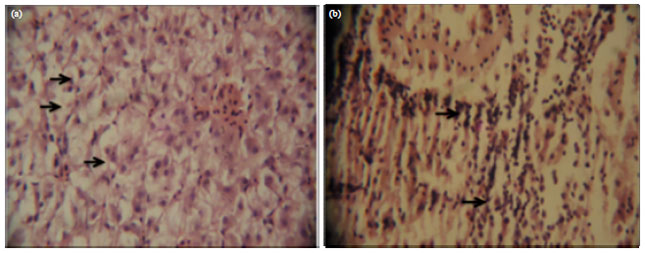 Image for - Histological Changes in the Liver and Kidney of Clarias gariepinus Fed Chrysophyllum albidum Seedmeal as Maize Replacer