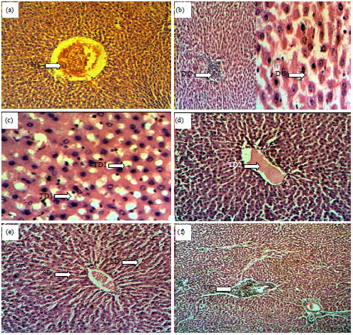 Image for - Hepatoprotective Effects of Crude Extracts of Pongamia pinnata in Alloxan Induced Diabetic Albino Wistar Rats