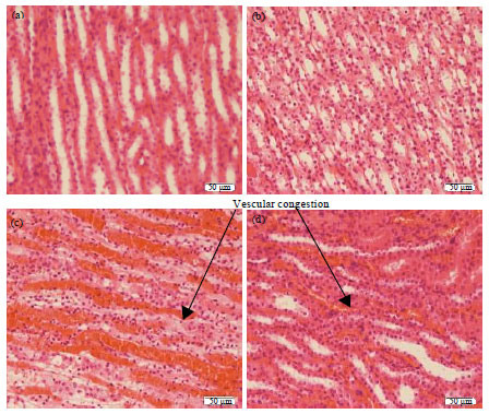 Image for - Berberine Improves Kidney Injury Following Renal Ischemia Reperfusion in Rats