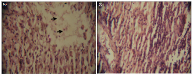 Image for - Histological Changes in the Liver and Kidney of Clarias gariepinus Fed Chrysophyllum albidum Seedmeal as Maize Replacer