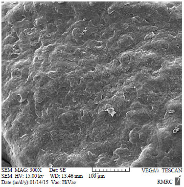 Image for - Fine Structure of Lingual Papillae in the Markhoz Goat (Iranian Angora): A Scanning Electron Microscopic Study