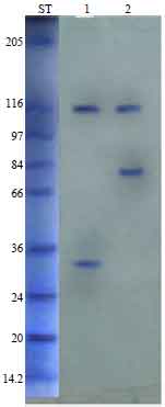 Image for - Diagnosis of Human Toxoplasmosis Using Toxoplasma gondii Tachyzoites Crude Antigen of Different Origin