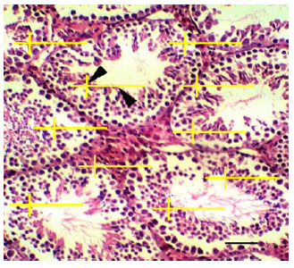 Image for - Stereological Study of the Testicular Tissue of the Persian Squirrel (Sciurus anomalus)