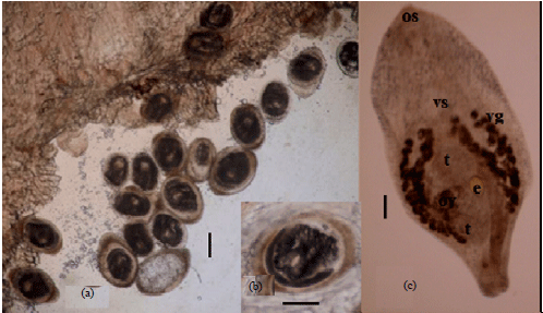 Image for - In vitro and In vivo Effects of Carica papaya Seed Extract on the Ultrastructure of the Tegument of Prohemistomum vivax (Sonsino, 1892) (Trematoda: Prohemistomatidae)