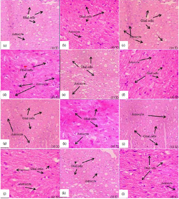 Image for - Repossession of Brain Complications in a Streptozotocin Induced Diabetic Rat by Exogenous Melatonin Administration
