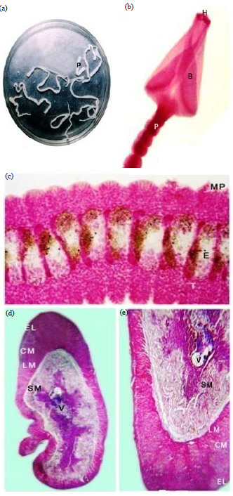 Image for - Mode of Attachment and Pathogenicity of Circumonchobothrium shindei (Eucestoda: Ptychobothriidae) in Mastacembelus armatus of River Godavari, Andhra Pradesh, India