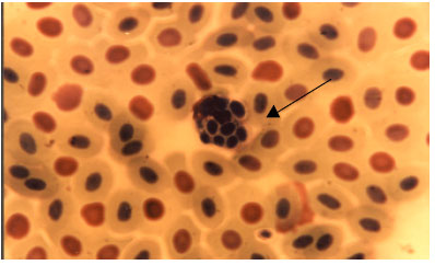 Image for - Effects of Low Concentration of Cadmium on the Level of Lysozyme in Serum,  Leukocyte Count and Phagocytic Index in Cyprinus carpio under the Wintering  Conditions