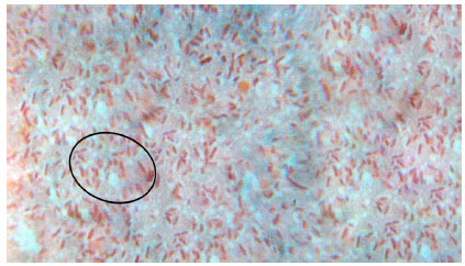 Image for - Incidence and Identification of Klebsiella pneumoniae in Mucosal Buccal Polyp of Nemipterus japonicus of Visakhapatnam Coast, India