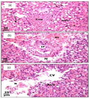 Image for - Protective Roles of Tomato Paste and Vitamin E on Cadmium-induced Histological and Histochemical Changes of Liver of Oreochromis niloticus (Linnaeus, 1758)
