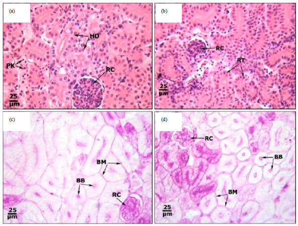 Image for - Effects of Cadmium on Some Histopathological and Histochemical Characteristics of the Kidney and Gills Tissues of Oreochromis niloticus (Linnaeus, 1758) Dietary Supplemented with Tomato Paste and Vitamin E
