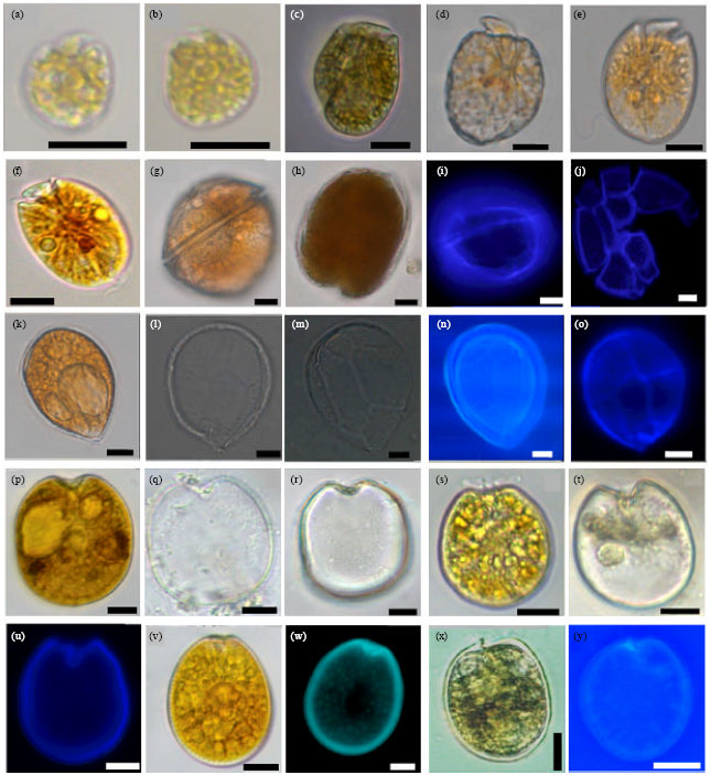 Image for - Occurrence of Sand-dwelling and Epiphytic Dinoflagellates Including Potentially  Toxic Species along the Coast of Jeju Island, Korea