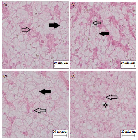 Image for - Histological Changes of Liver in Overfed Young Nile Tilapia