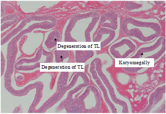 Image for - Histopathology of the Hepatopancreas of Pacific White Shrimp, Penaeus vannamei from None Early Mortality Syndrome (EMS) Shrimp Ponds