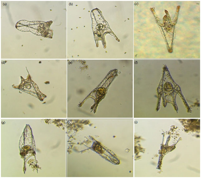 Image for - Larval Growth and Metamorphosis of South Eastern Mediterranean Sea Urchin Paracentrotus lividus (Echinodermata: Echinoidea) Fed Different Microalgal Diets
