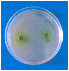 Image for - Antimicrobial Activity of Petroselinum sativum and Coriandrum sativum Seeds