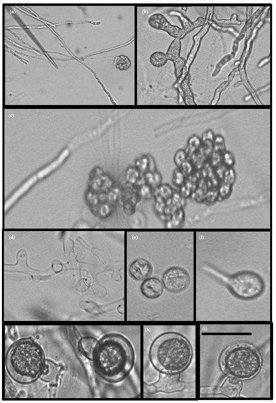 Image for - Materials for Pythium Flora of Saudi Arabia (I) Occurrence, Pathogenicity and Physiology of Reproduction of Pythium aphanidermatum (Edson) Fitzp. Isolated from North and East Regions of Saudi Arabia