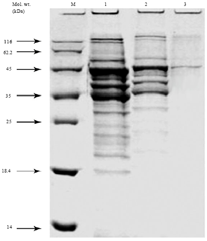 Image for - Characterization and Inhibition Effect of Conyza Leaf Extract (Pluchea dioscoridis) on Lipase Enzyme Produced by Aspergillus niger, Isolated from Otomycosis Disease