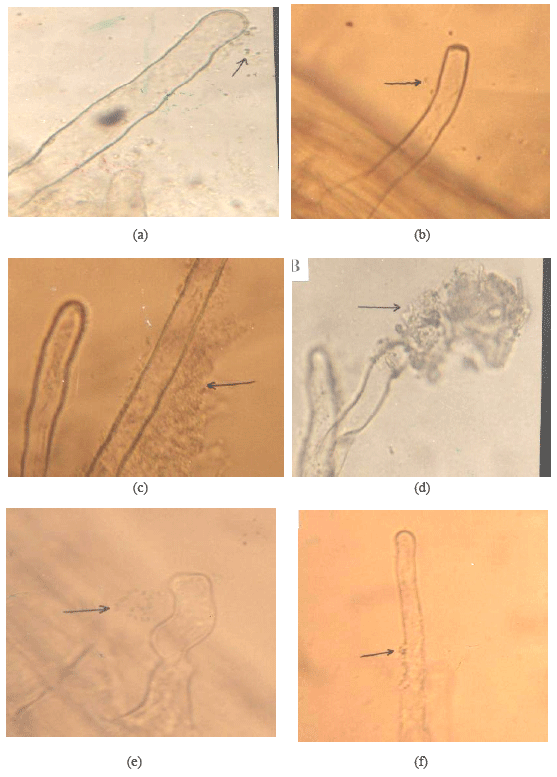 Image for - Colonization Potential of Ochrobactrum intermedium, Bacillus cereus and Brevibacterium sp. on Triticum aestivum and Helianthus annuus Roots