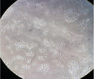 Image for - Callus Induction and Establishment of Cell Suspension Culture of Cumin (Cuminum cyminum L.)