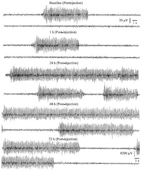 Image for - Effects of Intracerebroventricular Administration of 2-Chloroadenosine in Genetically Absence Epileptic WAG/Rij Rats