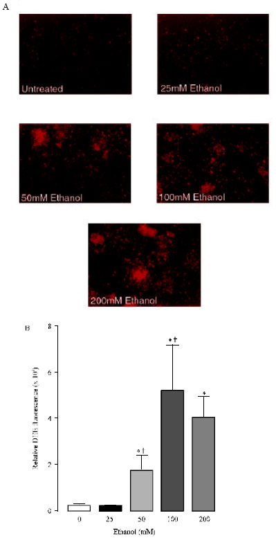 Image for - Ethanol Induces Cytotoxic Oxidative Stress in PC12 Cells: Protection by Reactive Oxygen Species Scavengers