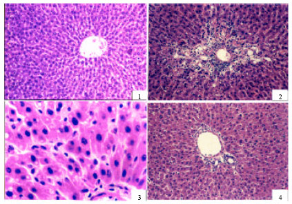 Image for - The Effect of Amlodipine, Diltiazem and Enalapril on Hepatic Injury Caused in Rats by the Administration of CCl4
