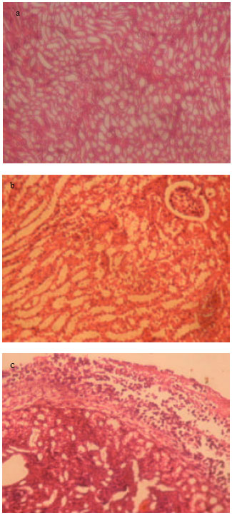 Image for - Histopathological Changes Induced in Mice after Inramuscular and Intra Peritoneal Injections of Venom from Spine-bellied Sea Snake, Lapemis curtus (Shaw, 1802)