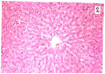 Image for - Effect of Calcitonin on Acute Hepatic Damage in Rats in vivo