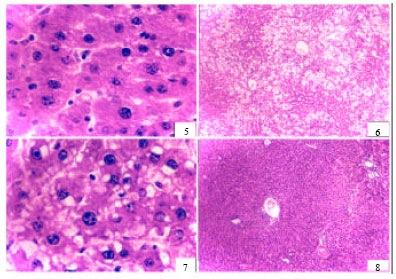 Image for - The Effect of Amlodipine, Diltiazem and Enalapril on Hepatic Injury Caused in Rats by the Administration of CCl4