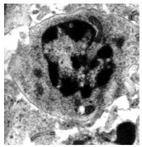 Image for - In vitro Evaluation of Uranium Induced Immunotoxicity in Chicken Lymphocytes