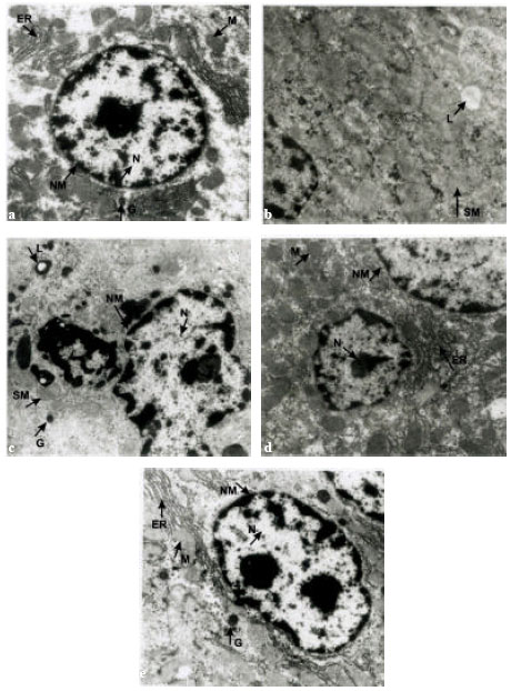 Image for - Ultrastructural and Biochemical Abnormalities in the Liver of Streptozotocin-Diabetic Rats: Protective Effects of Murraya koenigii