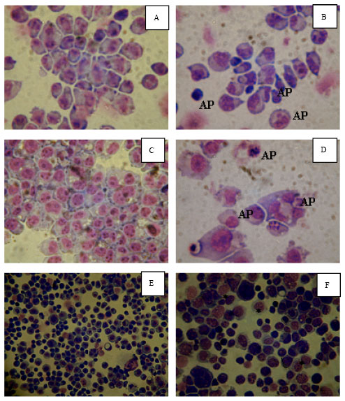 Image for - The Mechanism of Cryptolepine-Induced Cell Death