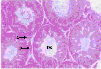 Image for - Histological Evaluation of the Rats Testis Following Administration of a Herbal Tea Mixture