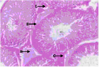 Image for - Histological Evaluation of the Rats Testis Following Administration of a Herbal Tea Mixture