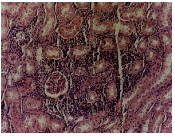 Image for - Histopathological, Hematobiochemical and Urinalysis Changes in Experimental Consumption of Oak (Quercus brantii) in Sheep