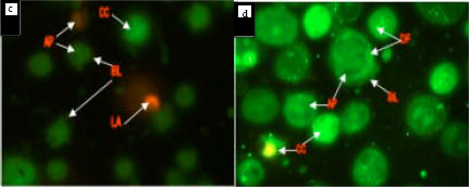 Image for - Anticancerous Effect of Typhonium flagelliforme on Human T4-Lymphoblastoid Cell Line CEM-ss