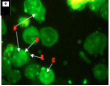 Image for - Anticancerous Effect of Typhonium flagelliforme on Human T4-Lymphoblastoid Cell Line CEM-ss