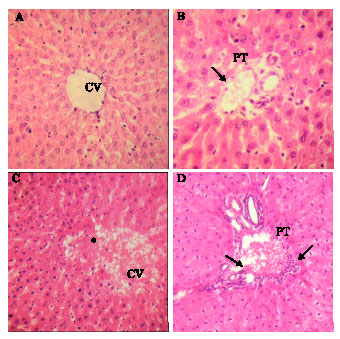 Image for - Hepatic Histopathological Abnormalities in Rats Treated Topically with Para-Phenylene  Diamine (PPD)