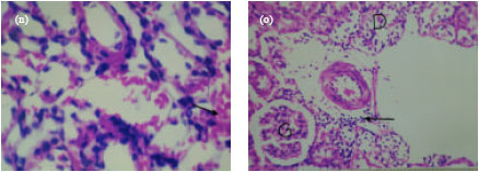 Image for - Dibutylnitrosamine Induces Histopathological Changes in Rat: Possible Protective Effects of Cinnamon Flavonoid Extract
