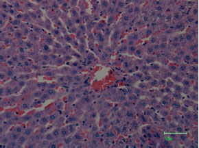 Image for - Effects of Mercury Exposure on Blood Chemistry and Liver Histopathology of Male Rats