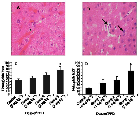Image for - Hepatic Histopathological Abnormalities in Rats Treated Topically with Para-Phenylene  Diamine (PPD)
