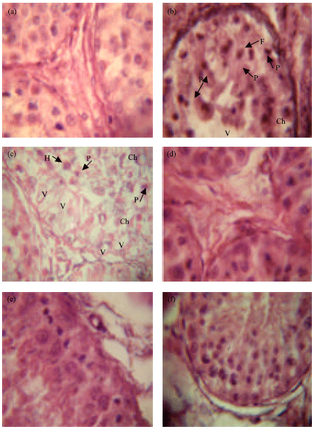 Image for - Ameliorating Effect of Vitamin E on Testicular Toxicity Induced by Endosulphan in Capra hircus in vitro