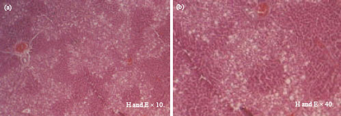 Image for - Hepatoprotective Activity of Capparis decidua Aqueous and Methanolic Stems Extracts Against Carbon Tetrachloride Induced Liver Histological Damage in Rats