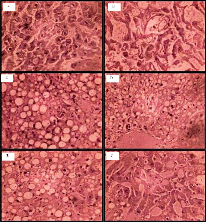 Image for - Hepatoprotective Effects of Clitoria ternatea and Vigna mungo against Acetaminophen and Carbon tetrachloride-induced Hepatotoxicity in Rats