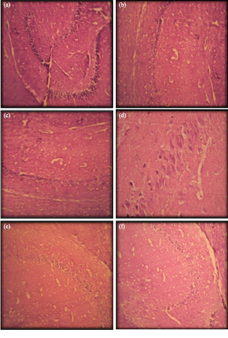 Image for - Cerebroprotective Effect of Root Extract of Asparagus racemosus Willd. in Global Cerebral Ischemia in Rats