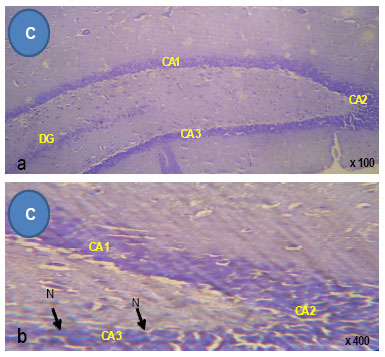 Image for - Neurohistological Degeneration of the Hippocampal Formation Following Chronic Simultaneous Administration of Ethanol and Acetaminophen in Adult Wistar Rats (Rattus norvegicus)