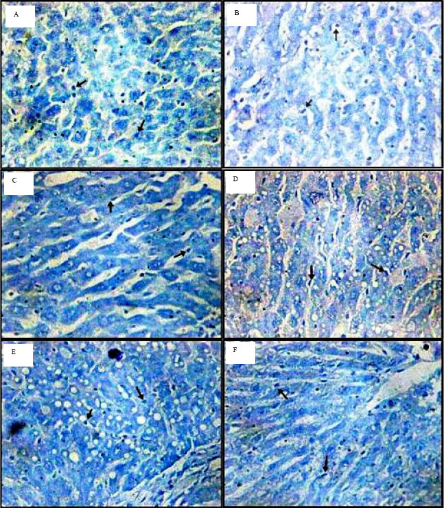 Image for - Hepatoprotective Effects of Clitoria ternatea and Vigna mungo against Acetaminophen and Carbon tetrachloride-induced Hepatotoxicity in Rats