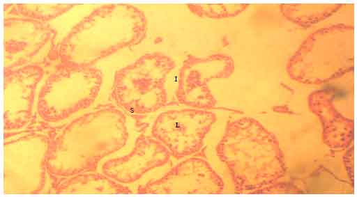Image for - Evaluation of the Histomorphometric Evidences of Hydroxyurea-induced Testicular Cytotoxicity in Sprague-Dawley Rat