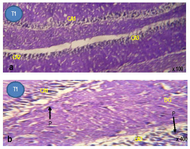 Image for - Neurohistological Degeneration of the Hippocampal Formation Following Chronic Simultaneous Administration of Ethanol and Acetaminophen in Adult Wistar Rats (Rattus norvegicus)