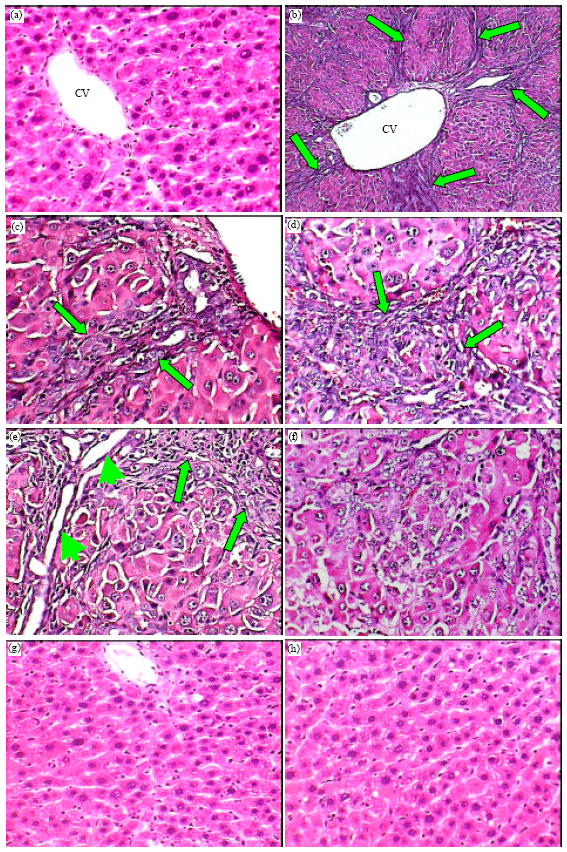 Image for - Hepatoprotective Influence of Vitamin C on Thioacetamide-induced Liver Cirrhosis in Wistar Male Rats